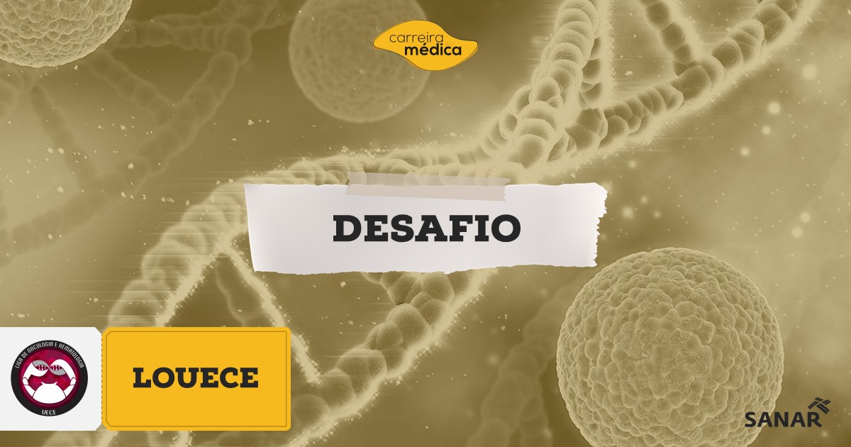 desafio-louece